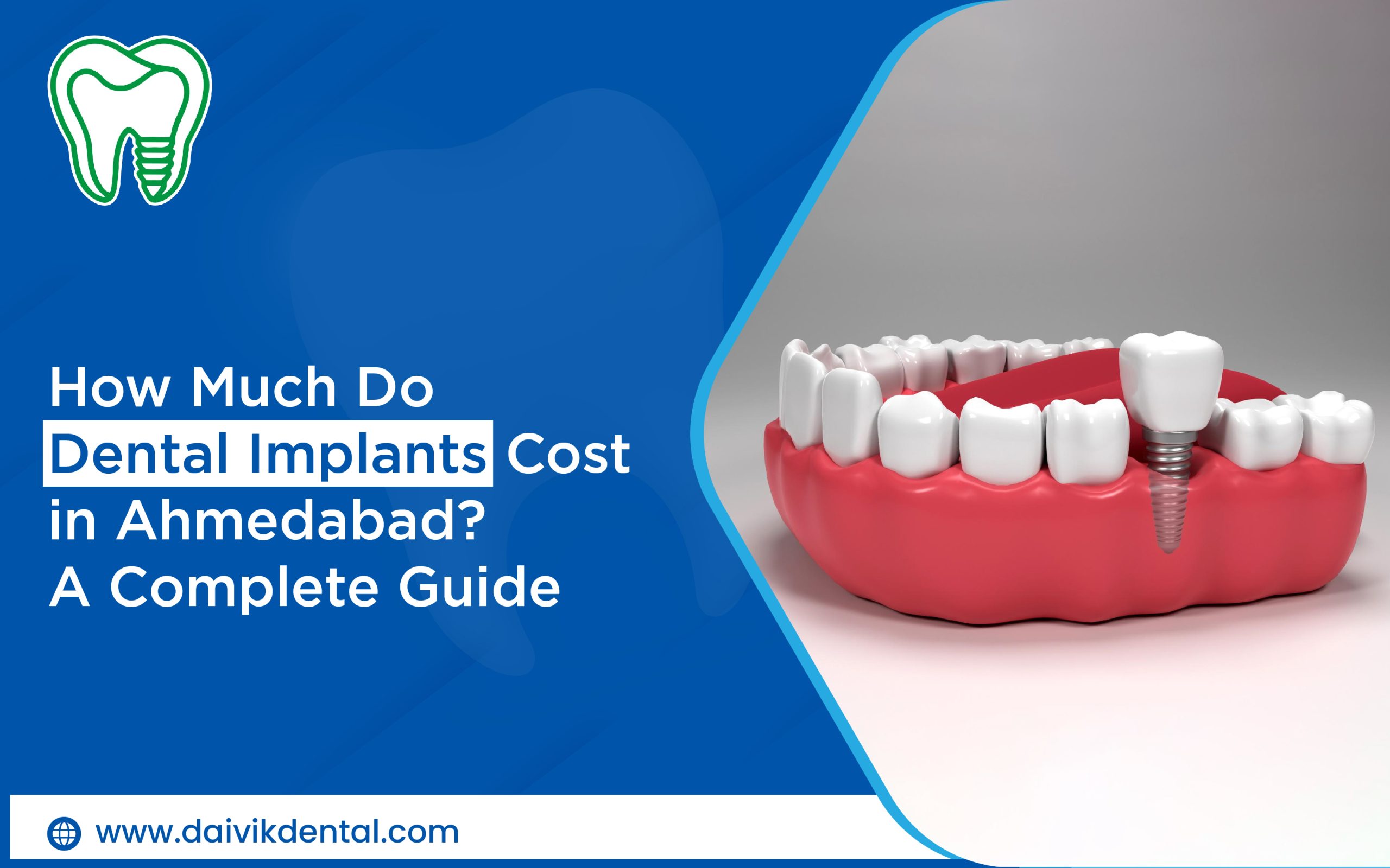 Dental implant cost in Ahmedabad