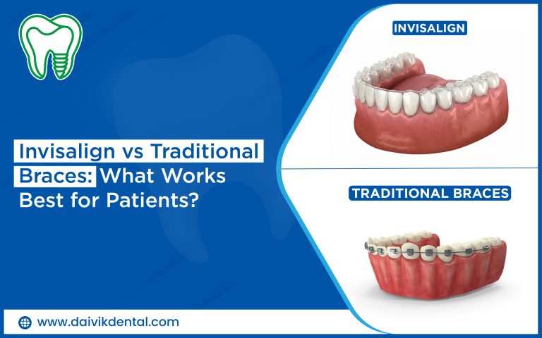 Teeth Straightening Treatment