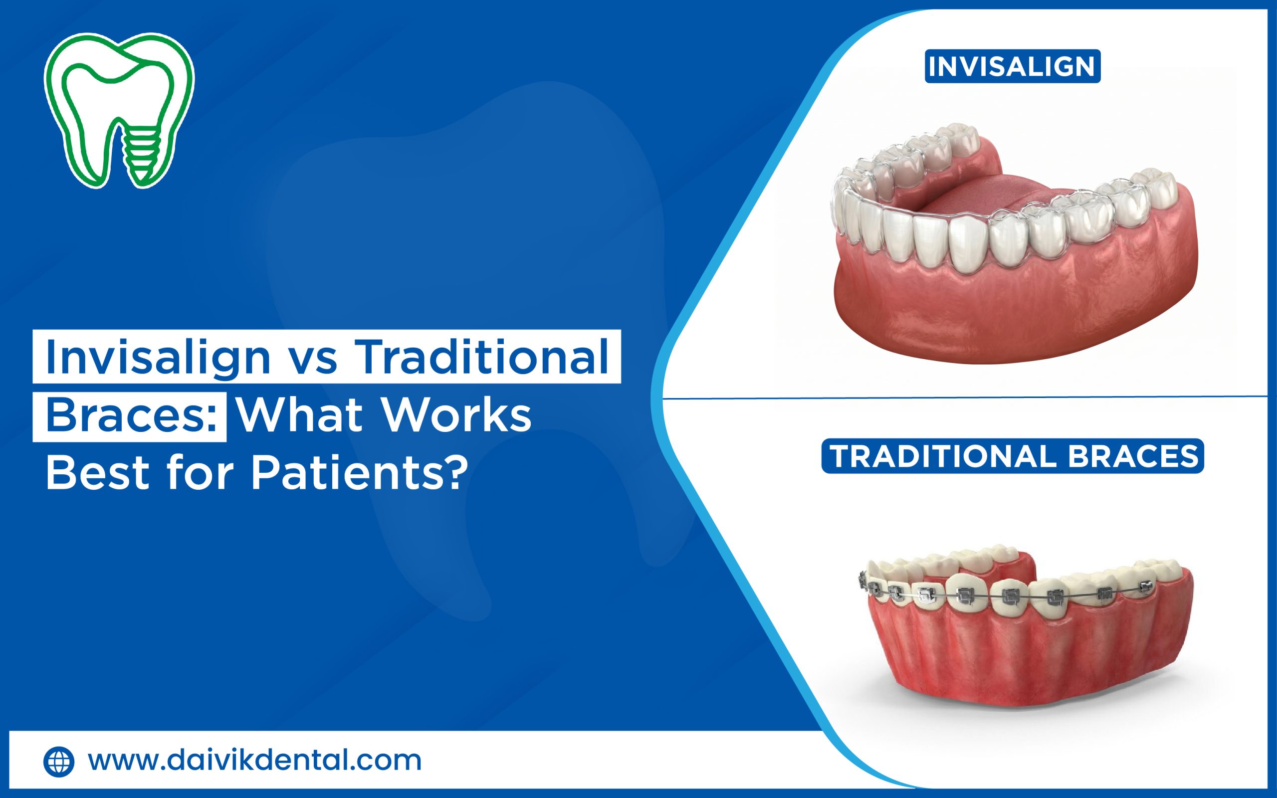Teeth Straightening Treatment