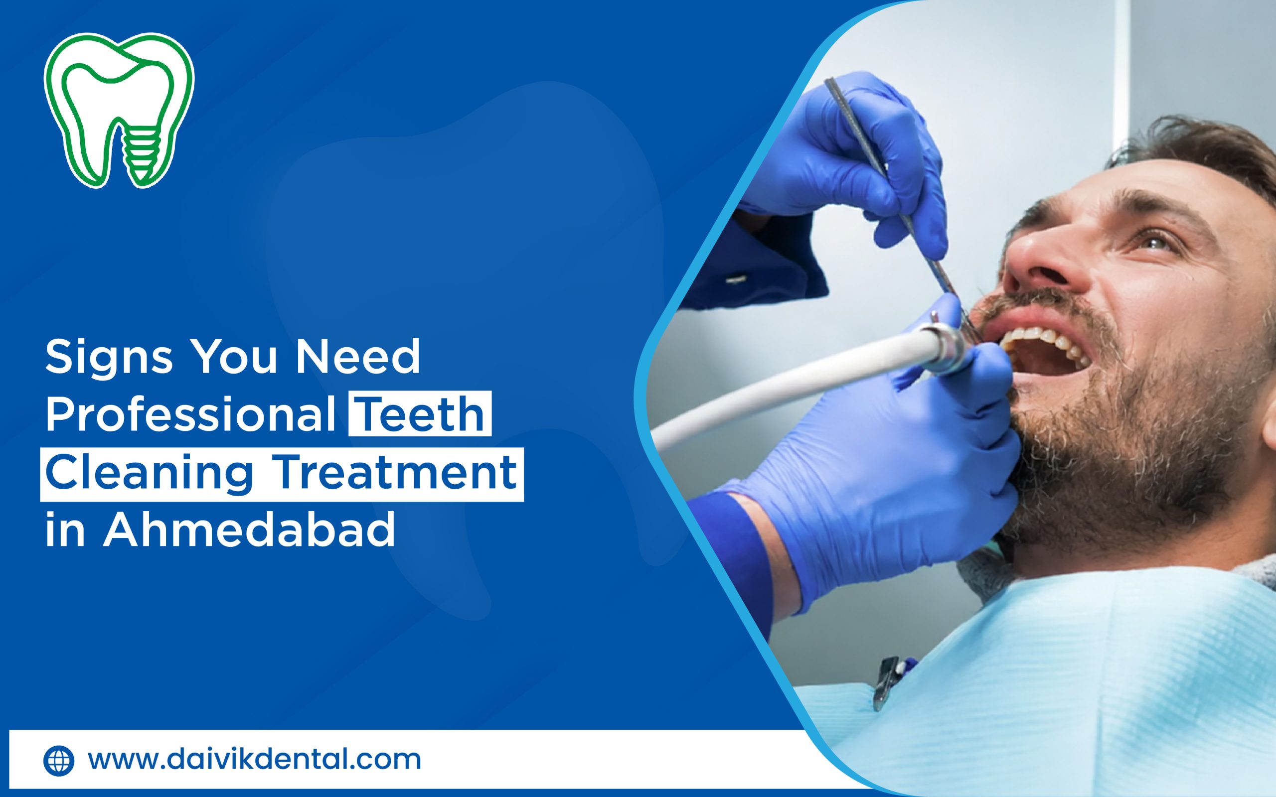 teeth cleaning treatment in Ahmedabad