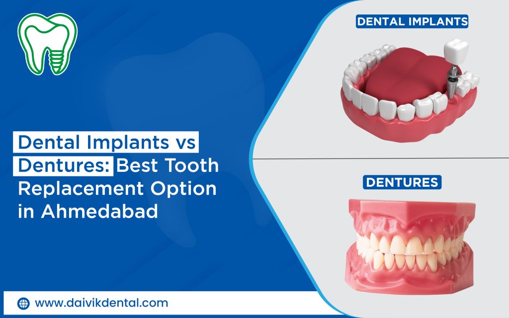 tooth replacement options implants vs dentures