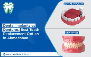 tooth replacement options implants vs dentures