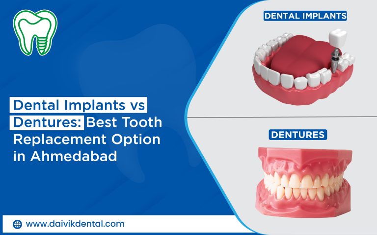 tooth replacement options implants vs dentures