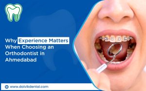 orthodontist in Ahmedabad