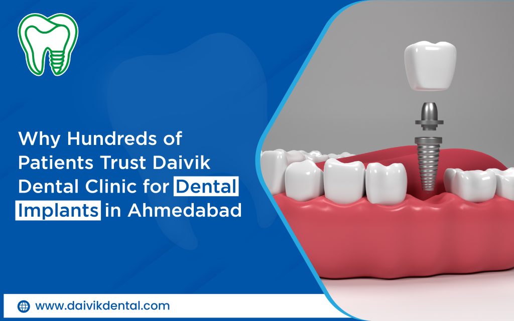 dental implant center in Ahmedabad