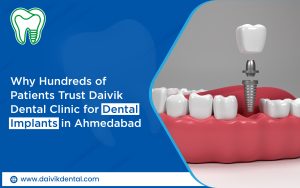 dental implant center in Ahmedabad