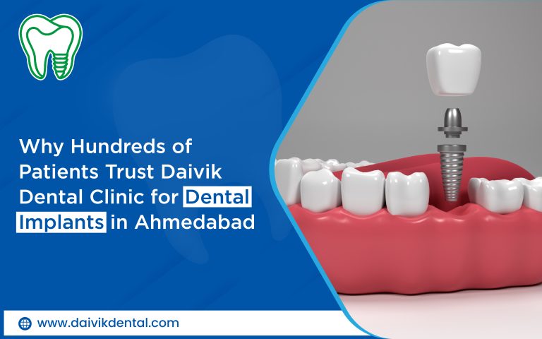 dental implant center in Ahmedabad