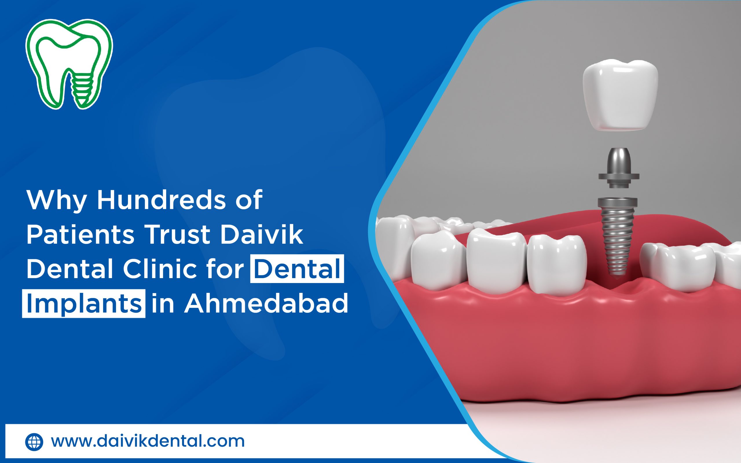 dental implant center in Ahmedabad