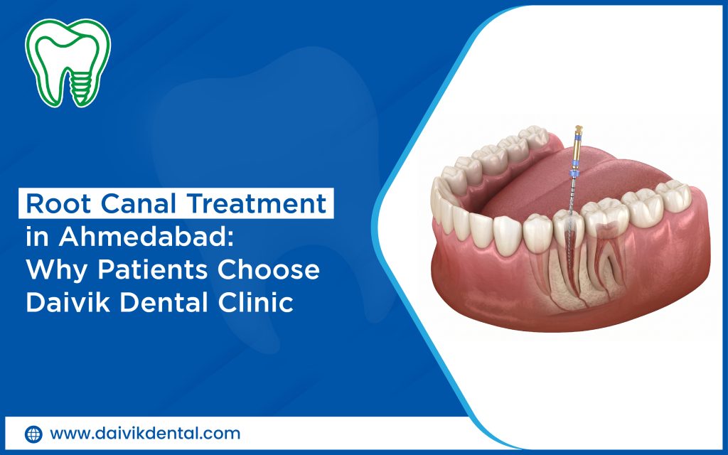 painless root canal treatment in ahmedabad