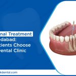 painless root canal treatment in ahmedabad