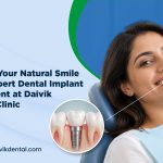 Dental Implant Treatment in Ahmedabad